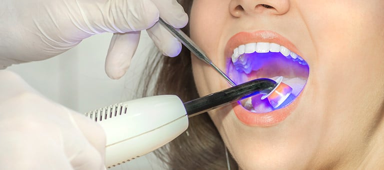 Dentist Filling Cavity
