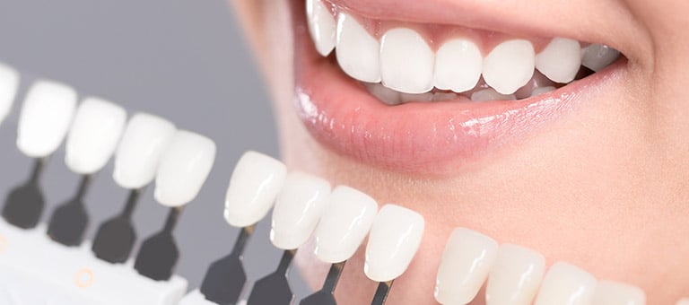 Shades of White Teeth